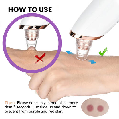 Imported™ Vacuum Pore Cleaner - Remove Blackheads Without Irritation or Redness